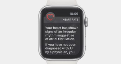 Apple Watch ECG app brings atrial fibrillation detection to the UK
