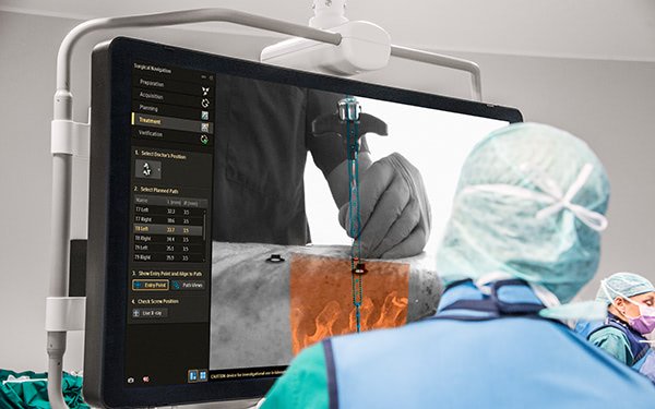 Philips Debutes Surgical Procedures Enabled by 3D Printing and Augmented Reality
